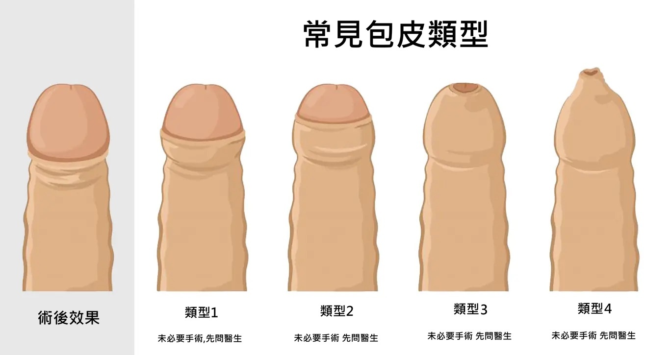 包皮構造示意圖